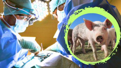 Exitoso segundo trasplante de corazón